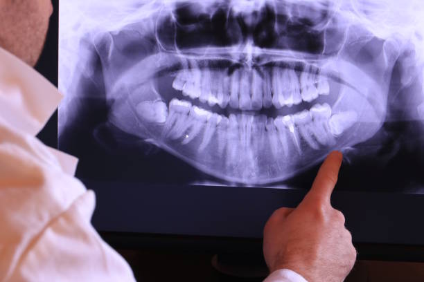 Best Emergency Tooth Extraction  in Hustisford, WI