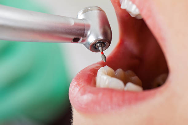 Best Broken Tooth Emergency  in Hustisford, WI